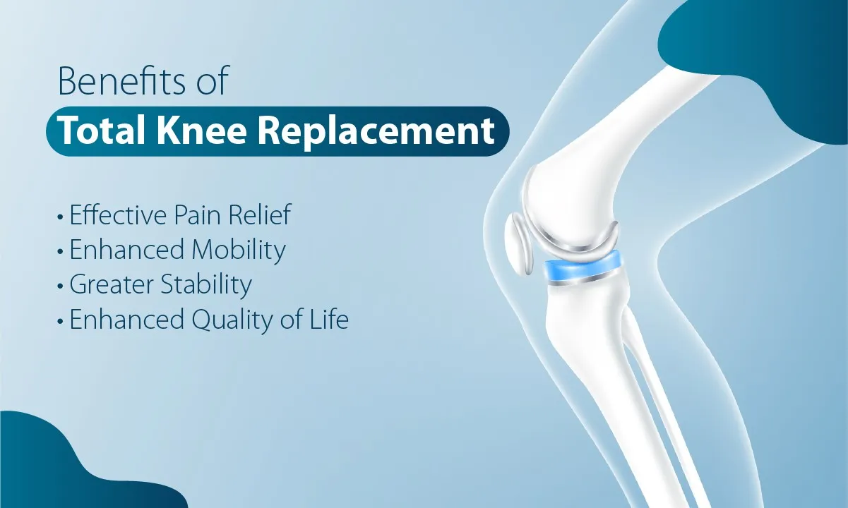 Total Knee Replacement Surgery Benefits